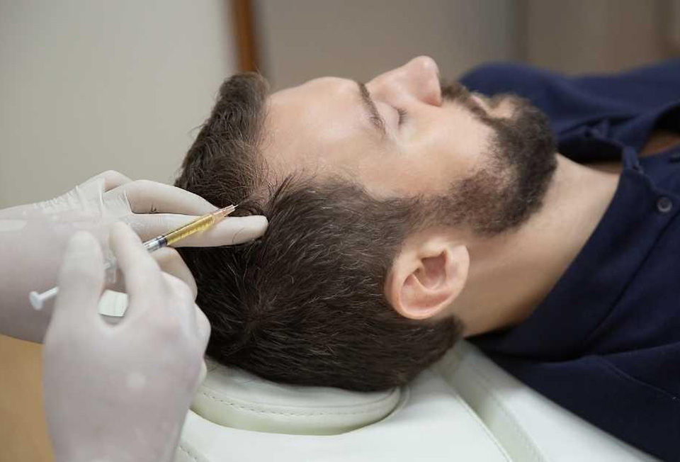 Specialized hair loss treatment for alopecia and pattern baldness in Kerala